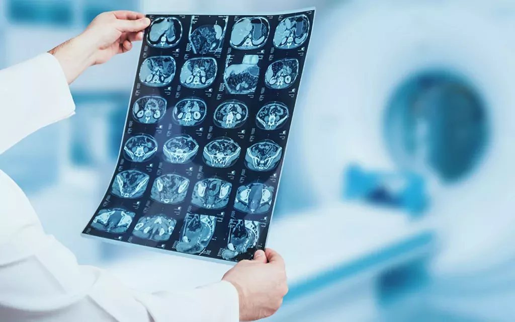 Santé : l’IA, nouvelle alliée de la radiologie